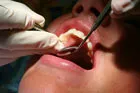 Woman having her teeth cleaned