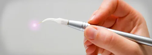 Dental laser
