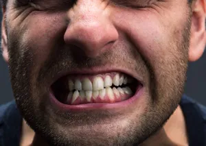 Man with bruxism
