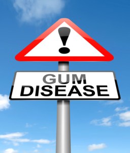 Gum disease sign