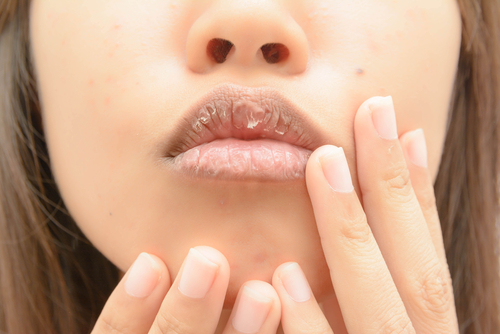 A woman feeling her mouth